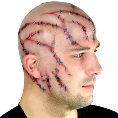 Stitches Bald Cap Appliance