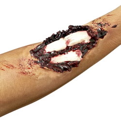 Compound Fracture Woochie
